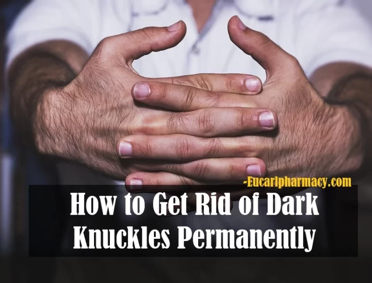 How to Get Rid of Dark Knuckles Permanently
