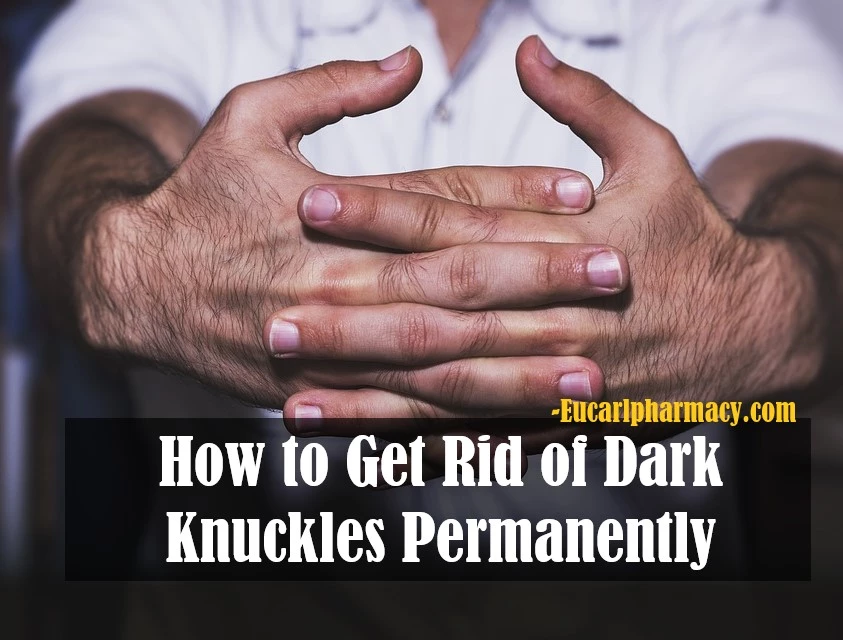 Get Rid Of Dark Knuckles