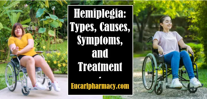 Hemiplegia: Types, Causes, Symptoms, and Treatment