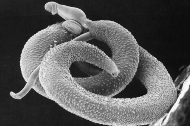 Helminths (Parasitic Worms) & How They Affect You